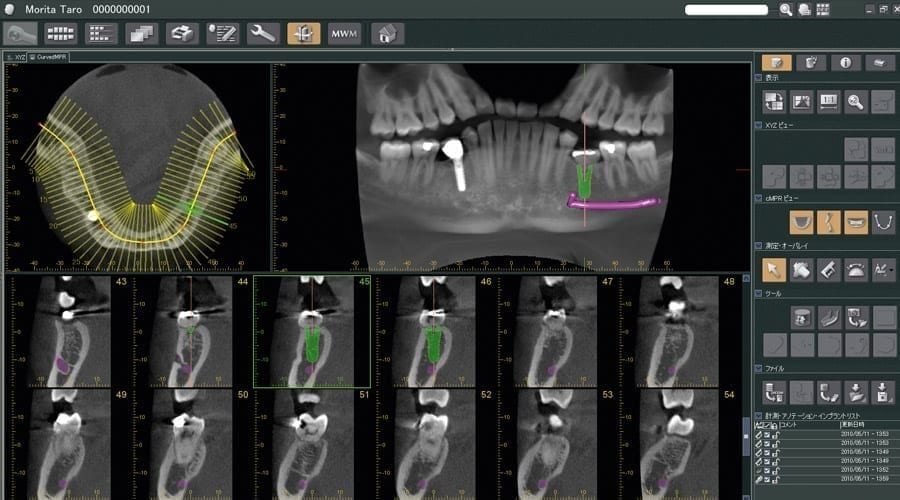 Imaging revisionato